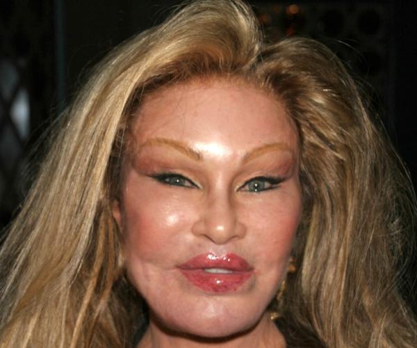 Jocelyn Wildenstein prima e dopo: tutti i ritocchi della “donna gatto”