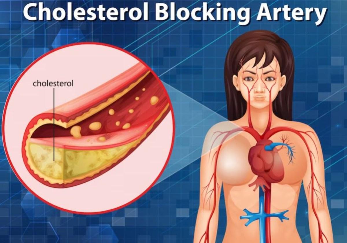 Quali cibi rallentano il colesterolo? Ecco gli alimenti in grado di ridurre il colesterolo LDL