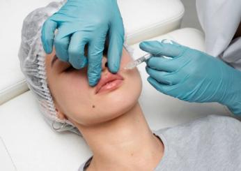 Filler labbra: cos’è, quanto costa e quanto dura. Fa male? Tutto sul trattamento estetico che dà volume alle labbra