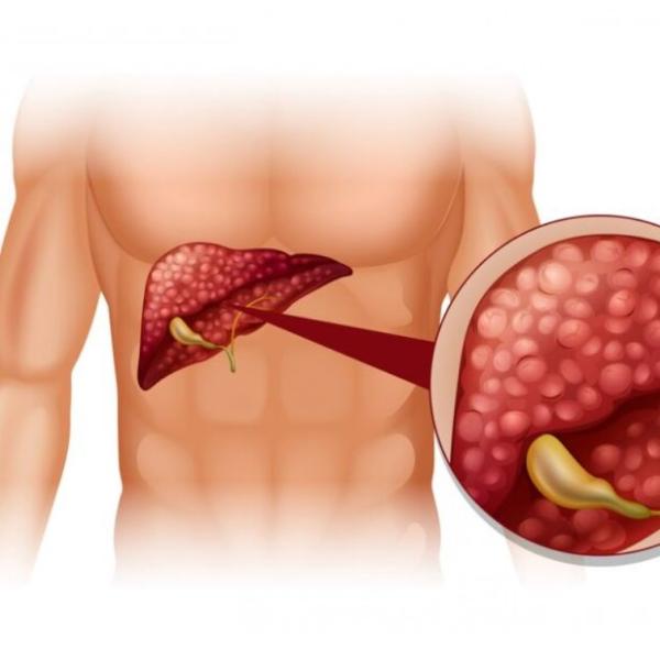 Nuova scoperta sul tumore al pancreas che dà una speranza: scoperto…