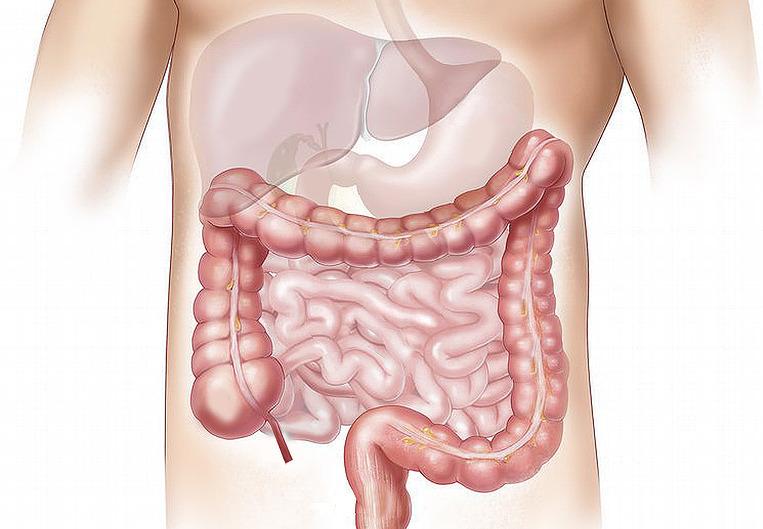 Diverticoli, cosa non mangiare? Ecco la dieta ideale