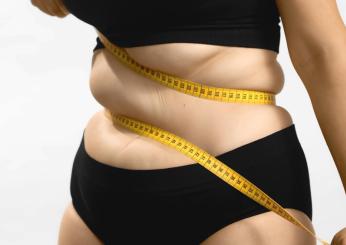 Che cos’è il lipedema e come riconoscerlo? Cure e cause