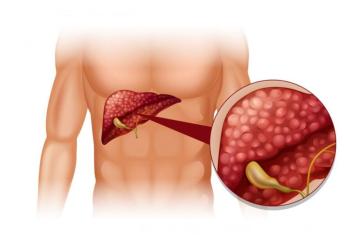 Nuova scoperta sul tumore al pancreas che dà una speranza: scoperto un meccanismo di crescita del cancro