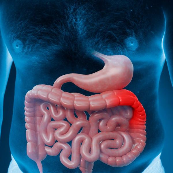 Come capire se si ha il morbo di Crohn, quali sono i sintomi e le cure