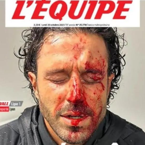 “Il disgusto e la vergogna”, l’Equipe apre con la foto del volto sanguinante di Fabio Grosso: polemica e rabbia nei commenti