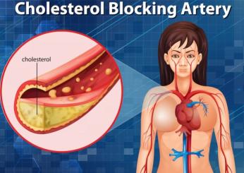 Quali cibi rallentano il colesterolo? Ecco gli alimenti in grado di ridurre il colesterolo LDL