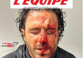 “Il disgusto e la vergogna”, l’Equipe apre con la foto del volto sanguinante di Fabio Grosso: polemica e rabbia nei commenti