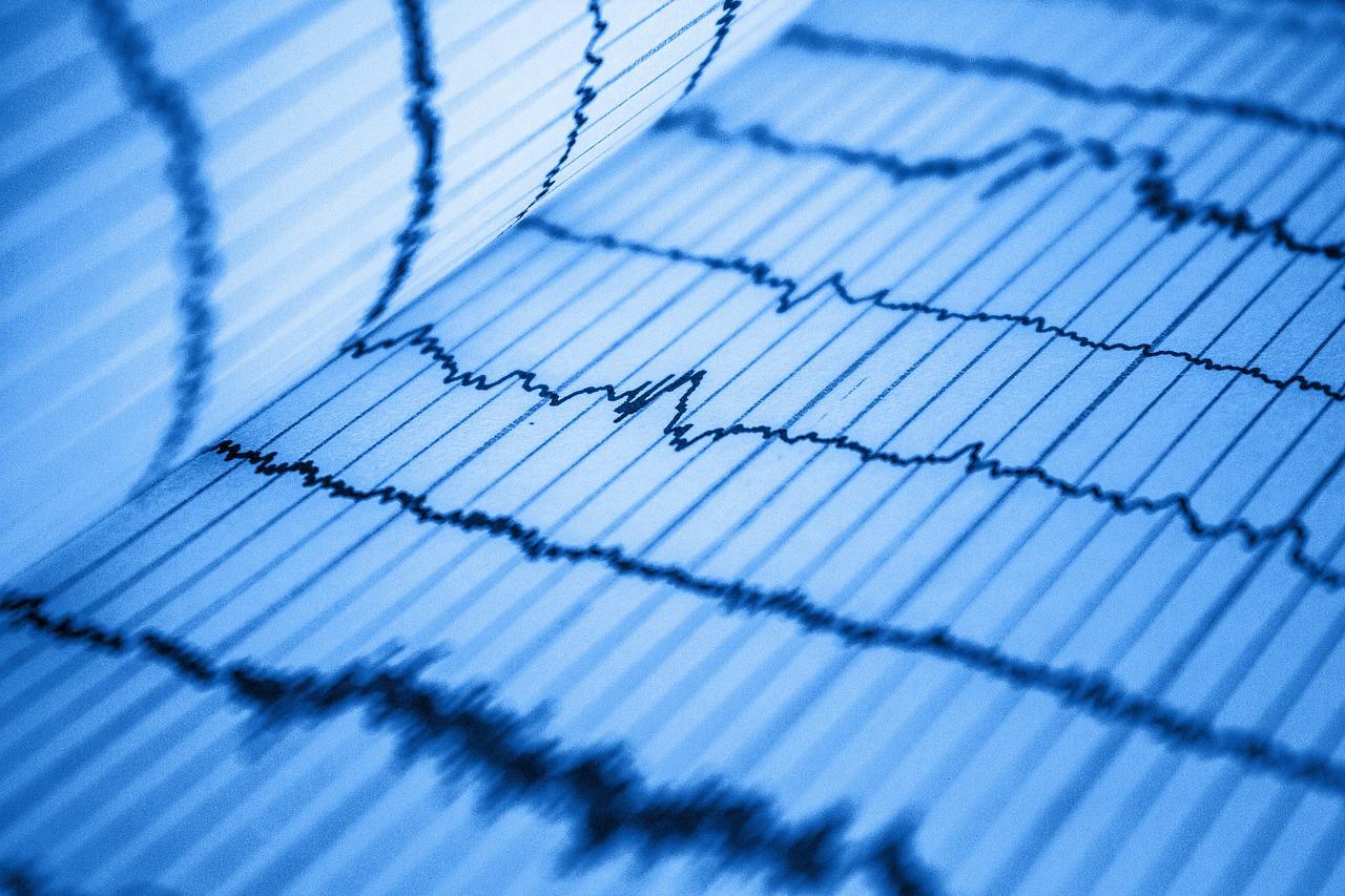 Fibrillazione atriale: cos’è, quali sono i sintomi, le cause e la terapia