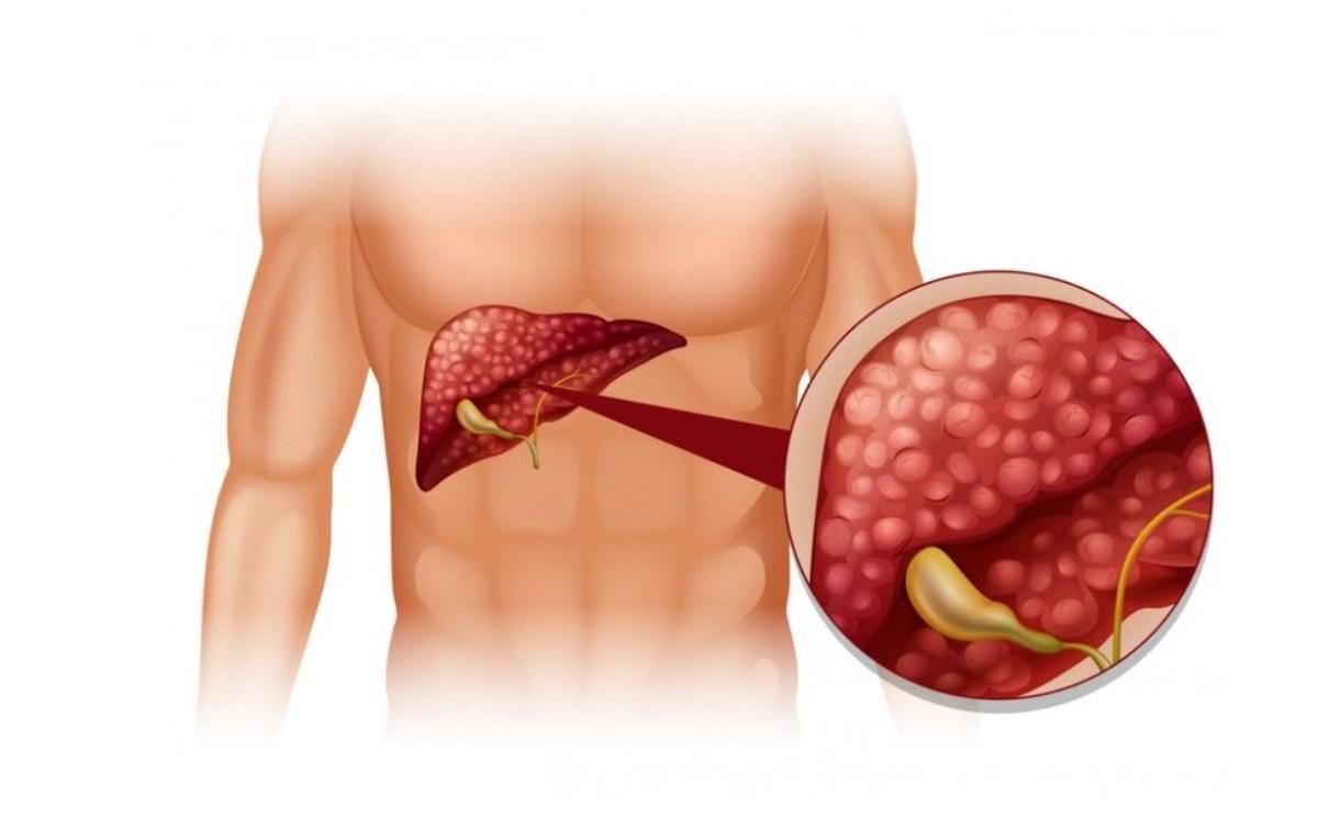 Nuova scoperta sul tumore al pancreas che dà una speranza: scoperto un meccanismo di crescita del cancro