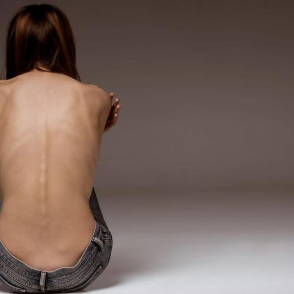 Quali sono i segnali dell’anoressia nervosa e i trattamenti che funzionano