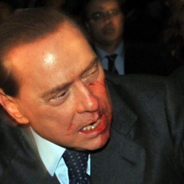 Il 13 dicembre 2009  Massimo Tartaglia colpisce il premier Silvio Berlusconi con una statuetta del Duomo. Il Cavaliere è una maschera di sangue | VIDEO E FOTO