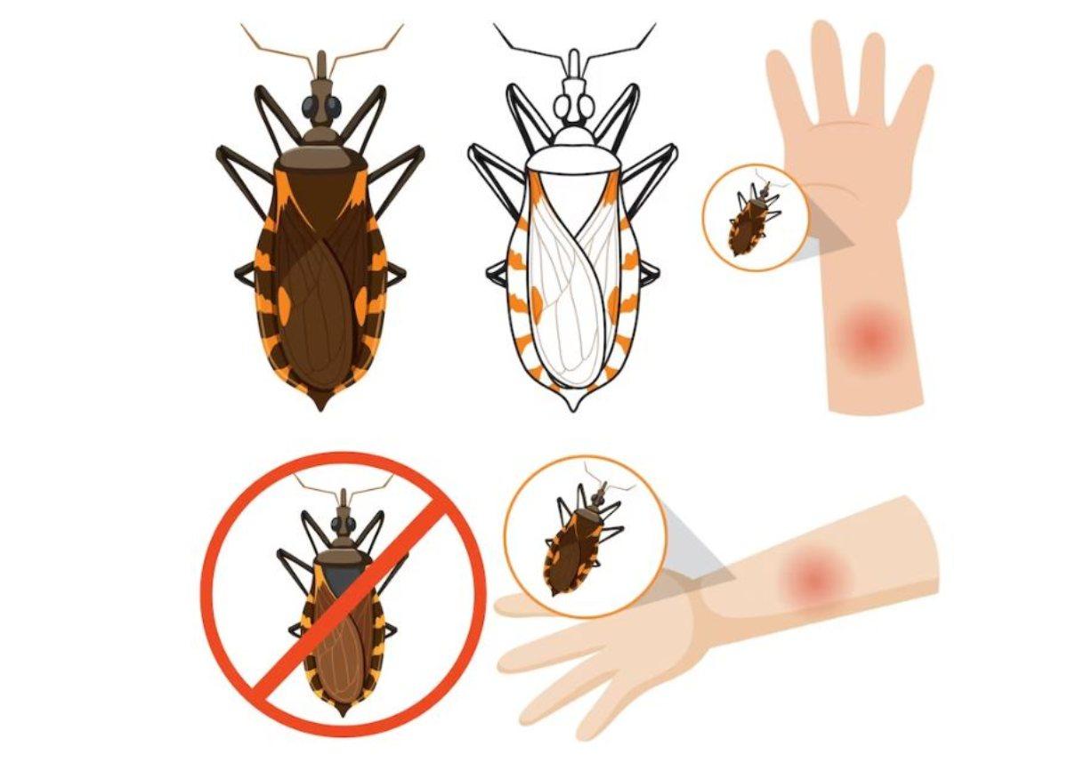 Allarme malattia di Chagas: sintomi, diagnosi e terapia