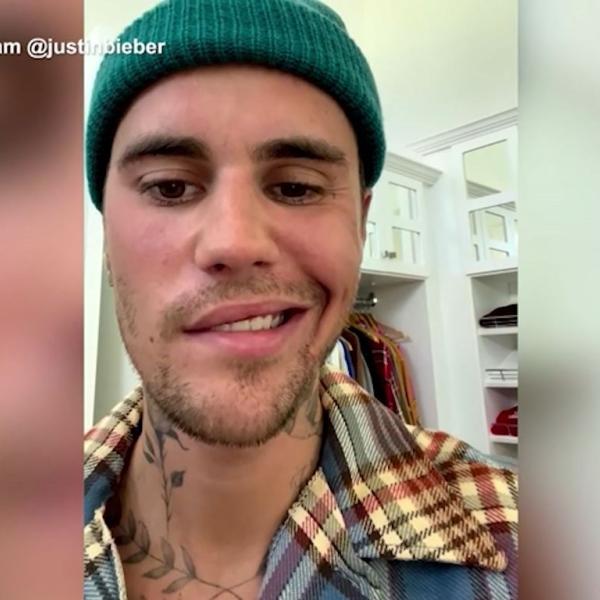 Justin Bieber: “Ho una paralisi al volto, ecco perché ho fermato il tour”