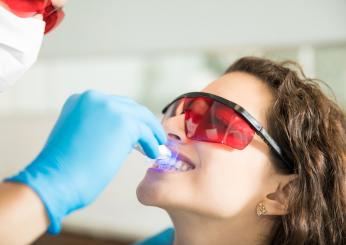 Lo sbiancamento dei denti è dannoso? In cosa consiste e quali sono le controindicazioni