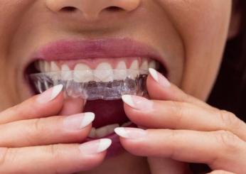 Digrignare i denti quali problemi può causare, a chi rivolgersi e cosa fare per smettere