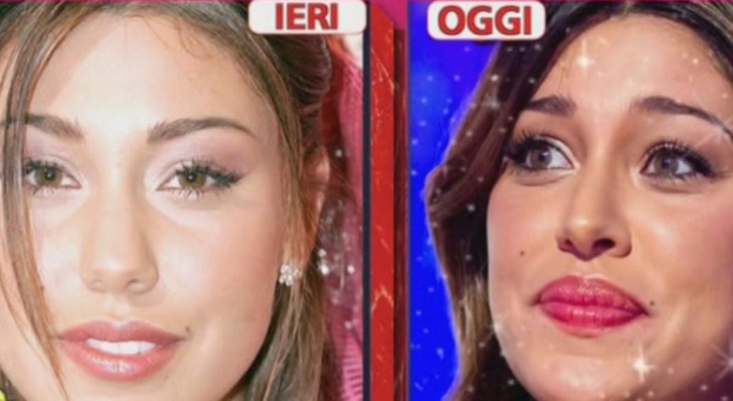 Belen è rifatta? Le foto prima e dopo la chirurgia estetica