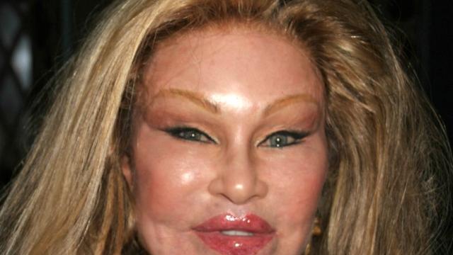 Jocelyn Wildenstein prima e dopo: tutti i ritocchi della “donna gatto”