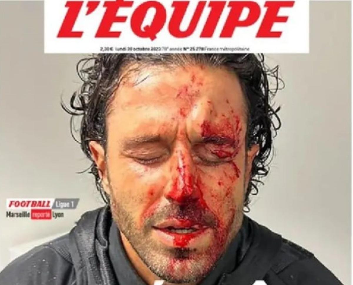 “Il disgusto e la vergogna”, l’Equipe apre con la foto del volto sa…