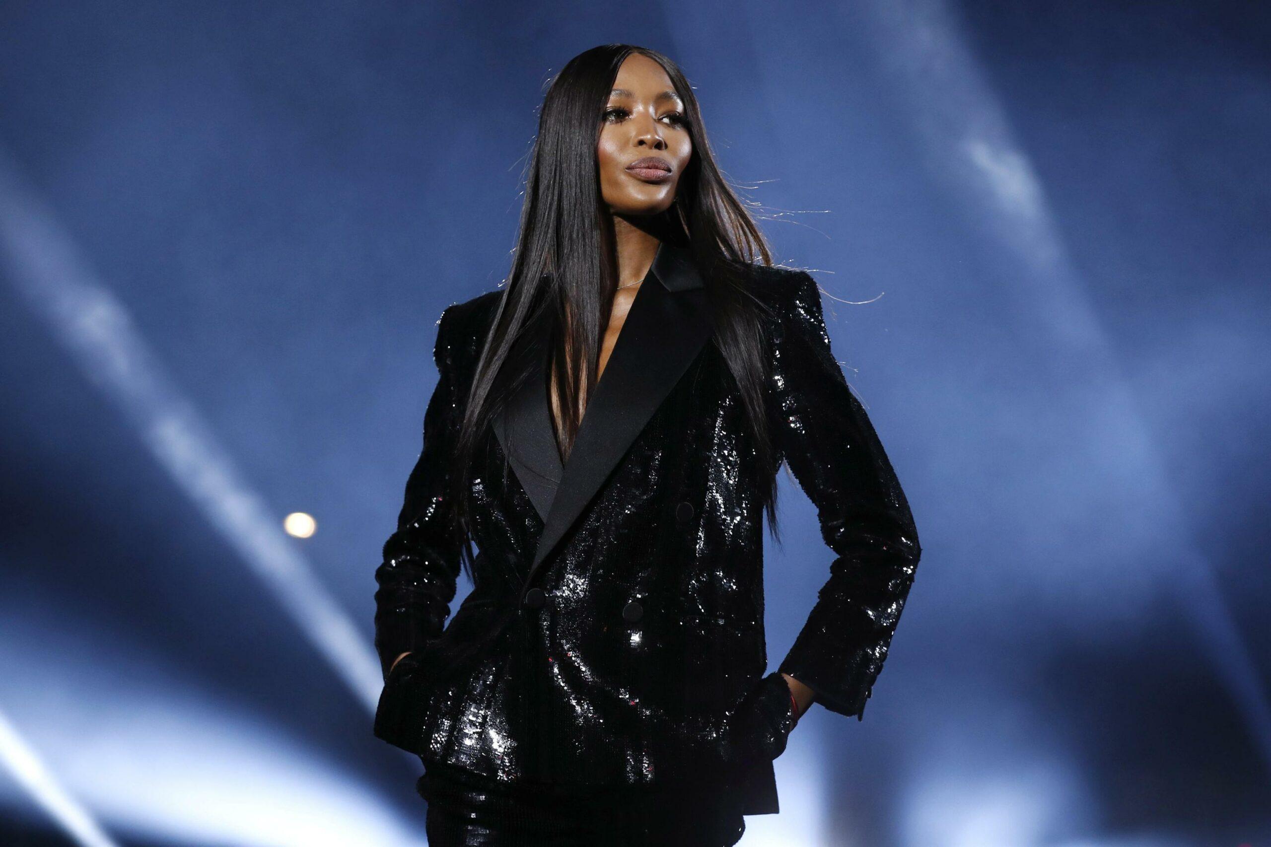 Che malattia ha Naomi Campbell? Dall’alopecia alla dipendenza da cocaina