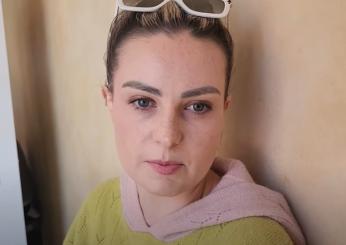 Chi è Molly Burke, la beauty influencer cieca con 3 milioni di follower che combatte le disabilità