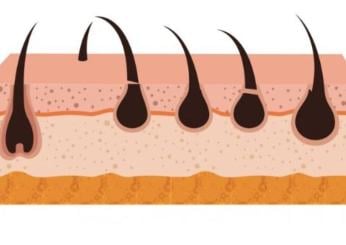 A cosa è dovuta la follicolite, cosa fare per farla passare e quanto tempo ci vuole