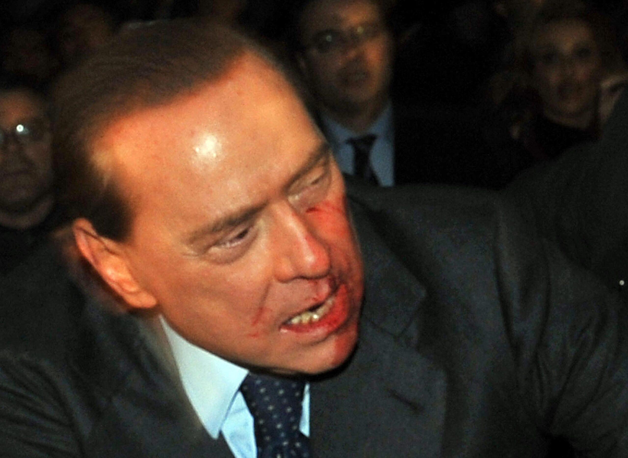 Il 13 dicembre 2009  Massimo Tartaglia colpisce il premier Silvio Berlusconi con una statuetta del Duomo. Il Cavaliere è una maschera di sangue | VIDEO E FOTO