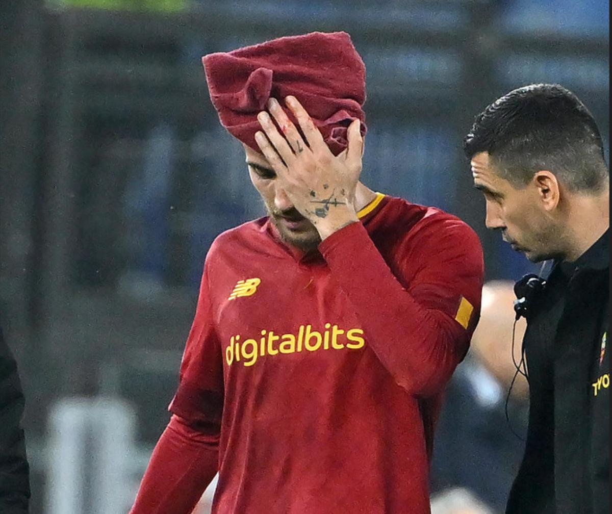 Come sta Lorenzo Pellegrini? Ecco l’esito della tac