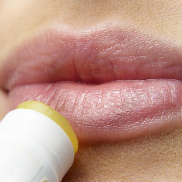 Herpes labiale, quando preoccuparsi? Sintomi, cure e prevenzione