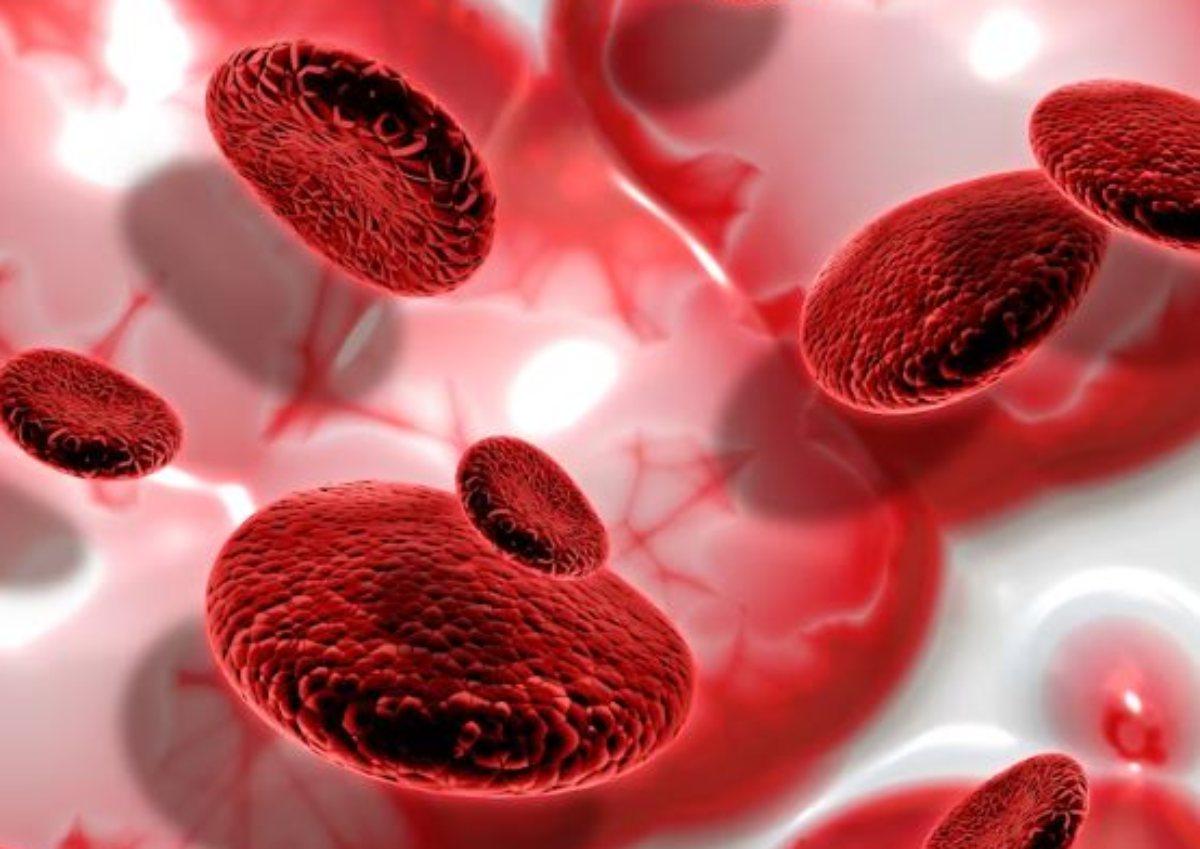 Quali sono i sintomi dell’anemia perniciosa, come si diagnostica e qual è la cura