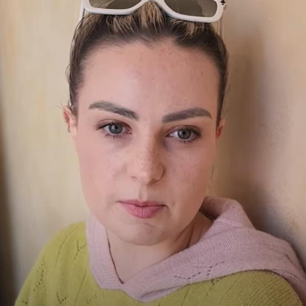 Chi è Molly Burke, la beauty influencer cieca con 3 milioni di follower che combatte le disabilità