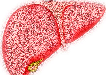 La fibrosi epatica cos’è e quando si manifesta? Tutto quello che c’è da sapere su questa epatopatia