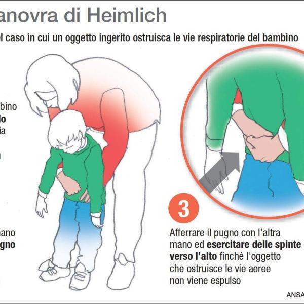 Manovra di Heimlich: come si fa e perché può salvare la vita