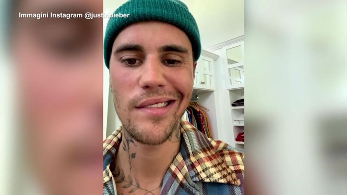 Justin Bieber: “Ho una paralisi al volto, ecco perché ho fermato il…