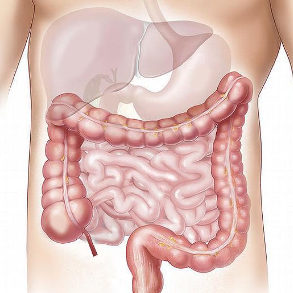 Diverticoli, cosa non mangiare? Ecco la dieta ideale