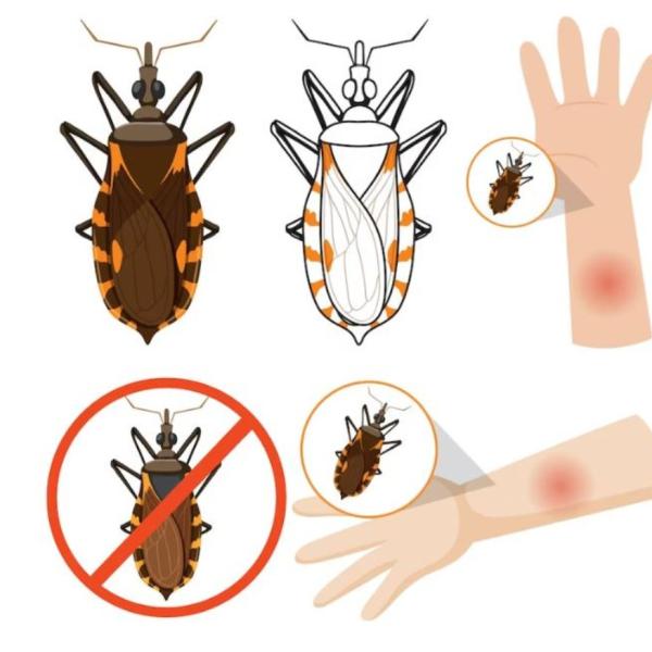 Allarme malattia di Chagas: sintomi, diagnosi e terapia