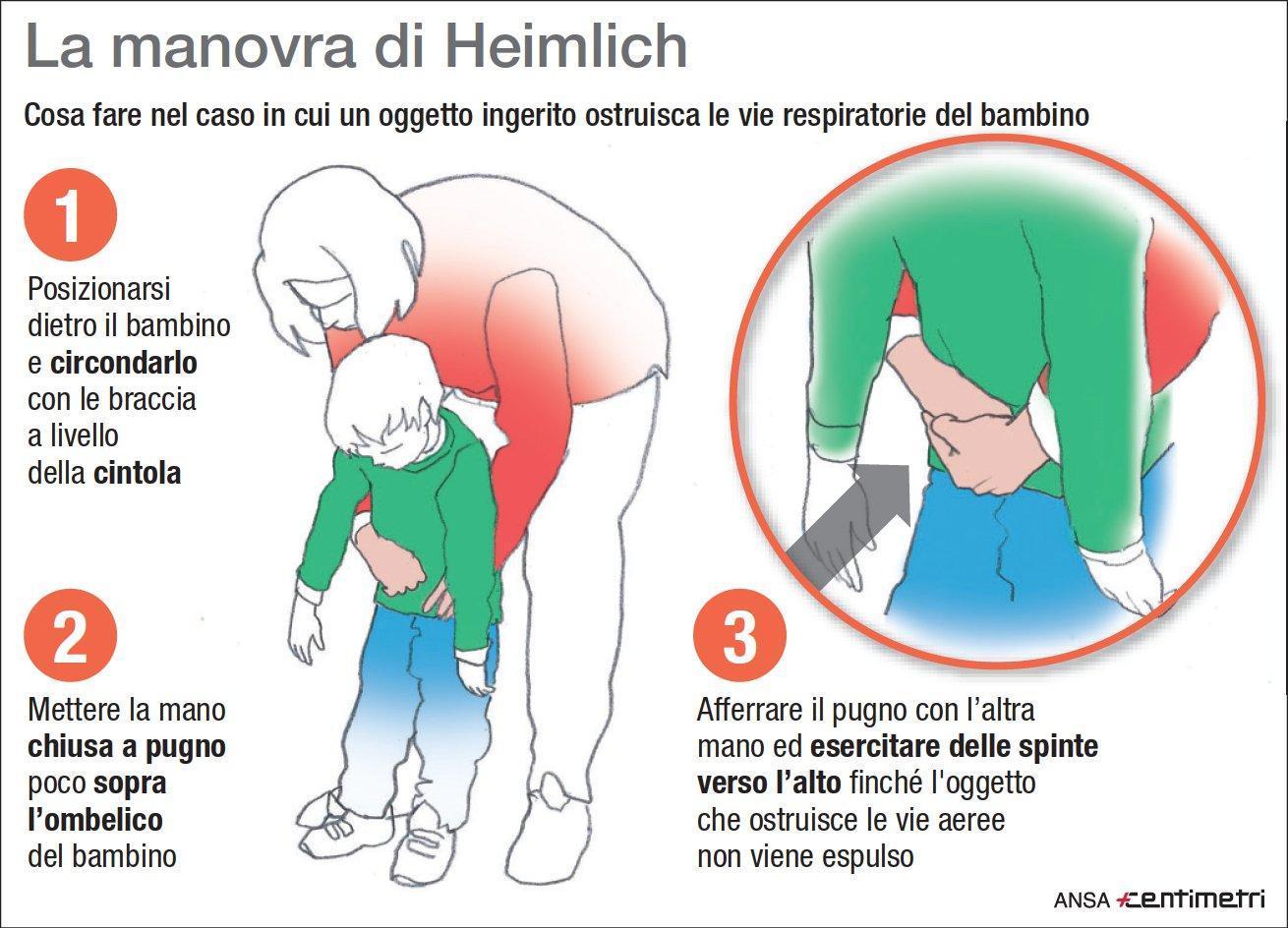 Manovra di Heimlich: come si fa e perché può salvare la vita