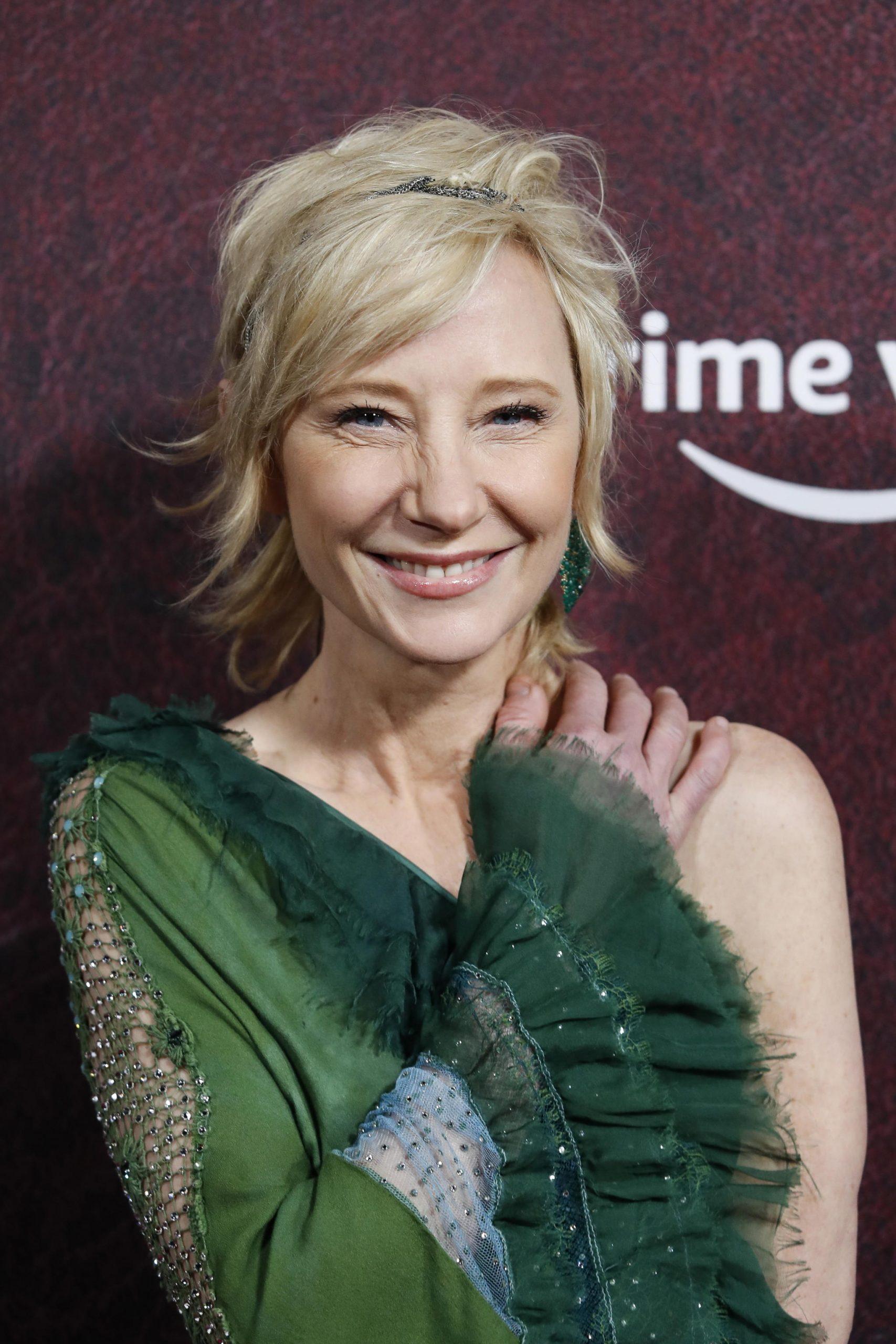 Anne Heche in fin di vita: si parla di donazione organi