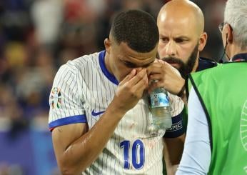 Mbappé, naso rotto ma niente intervento (per ora): quando torna e quante gare salta