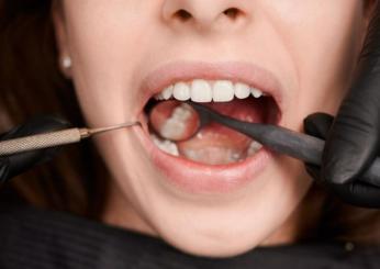 Quali alimenti macchiano i denti e cosa mangiare per avere denti più bianchi