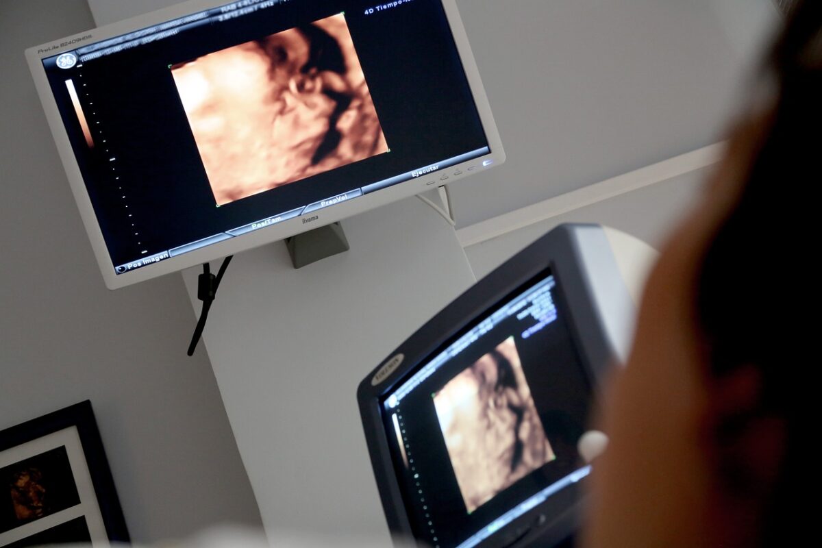 Milano, volantino in chiesa chiede modifica 194: obbligo di ascolto del battito del feto prima dell'aborto