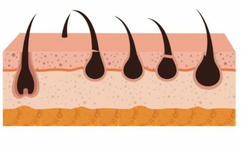 A cosa è dovuta la follicolite, cosa fare per farla passare e quanto tempo ci vuole