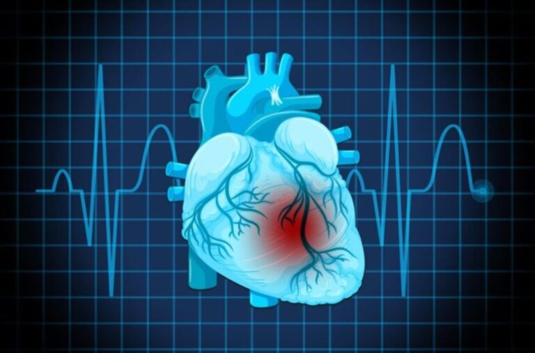 Quale attività fisica è adatta ai cardiopatici? Ecco come proteggere il cuore attraverso l'esercizio