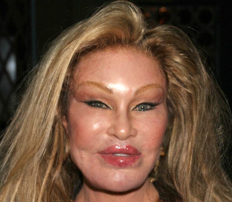 Jocelyn Wildenstein prima e dopo